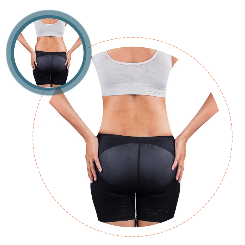 360 degree liposuction with abdominoplasty_Banner