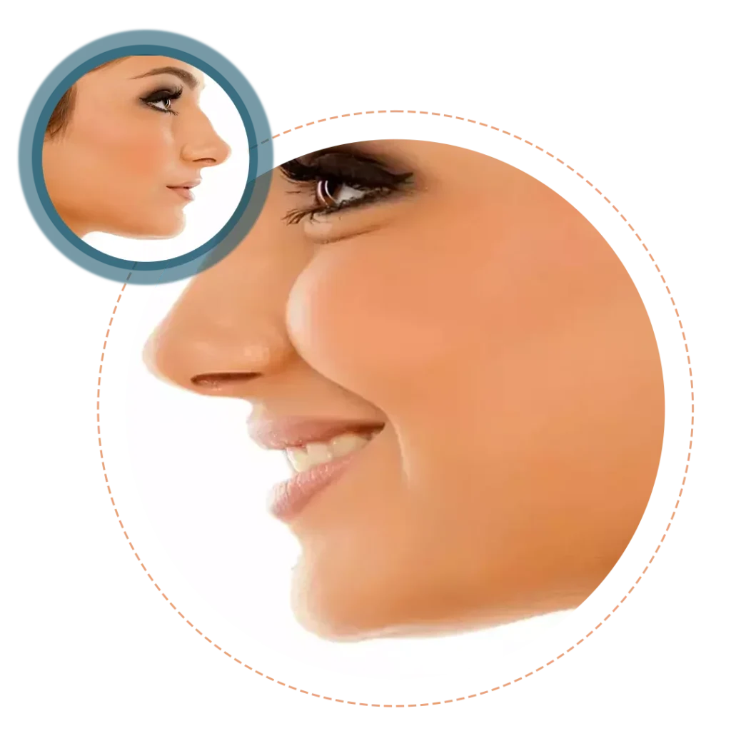 Facial Asymmetry Correction