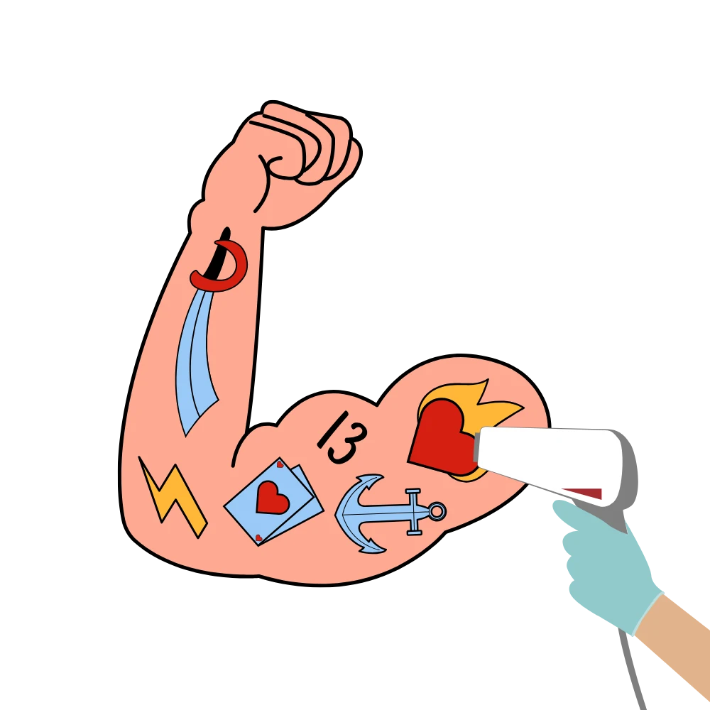 4. Fractional Laser