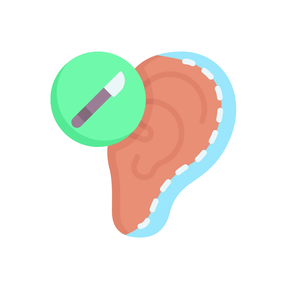 Incisionless Otoplasty